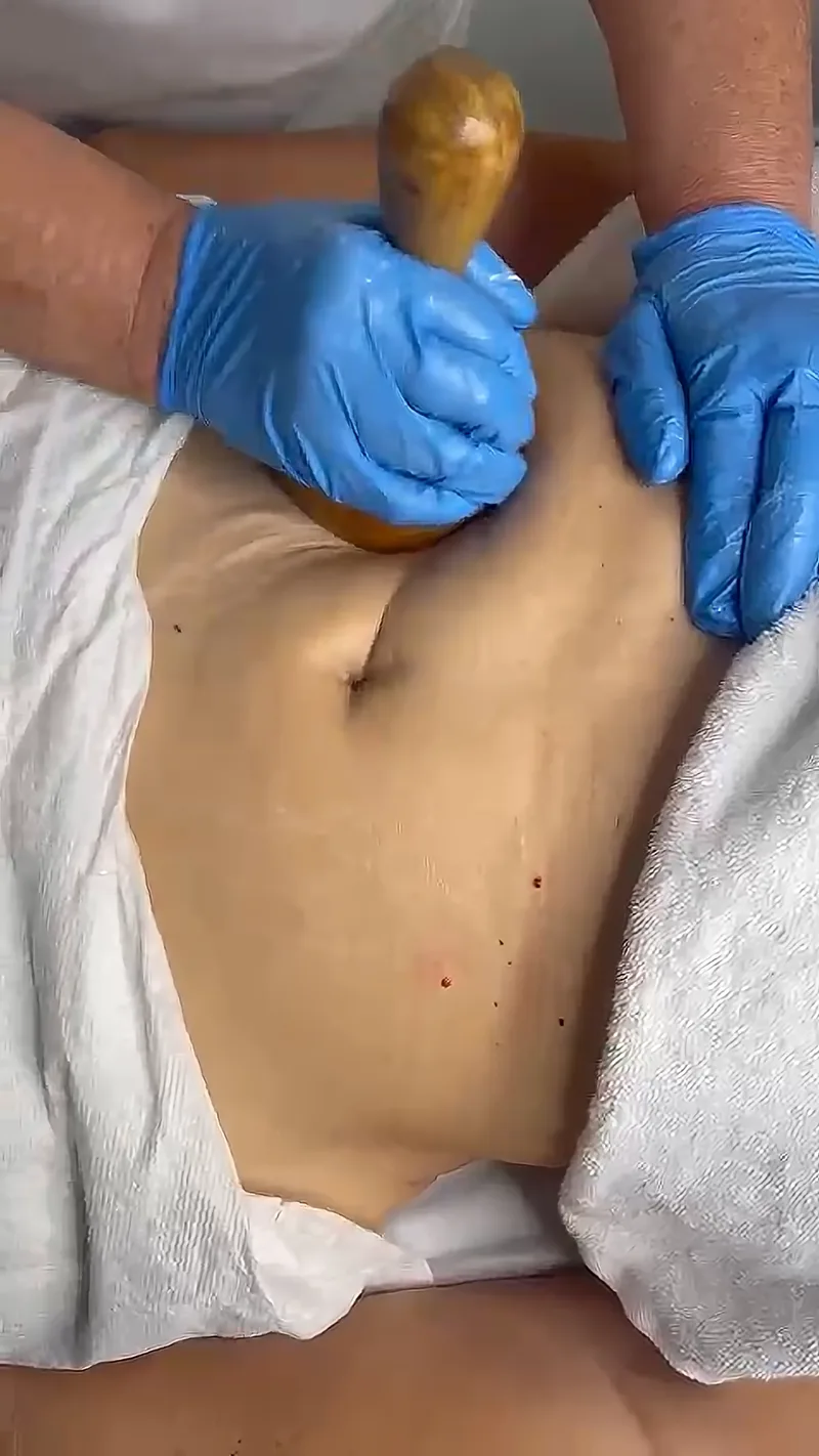 Body Rejuvenation